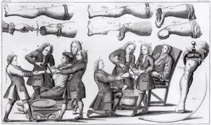 Opérations chirurgicales sur les membres - English School